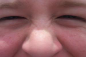 Squinty Eyes image