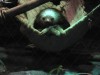 A sloth in a sling